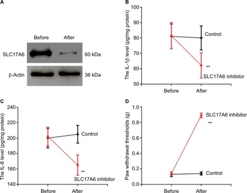 Figure 5 The therapeutic effect of SLC17A6 inhibitor in diabetic neuropathic pain. (A) The protein expression of SLC17A6; (B, C) the level of IL-1β and IL-6; (D) change in paw withdrawal thresholds.