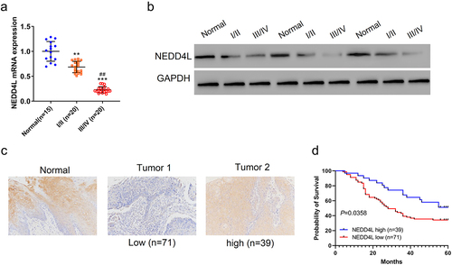 Figure 1. NEDD4L expression level was low in OSCC tissues and had prognostic correlation. Paraffin sections of Stage 1 or 2 OSCC tissues (I/II), Stage 3 or 4 OSCC tissues (III/IV), and adjacent non-tumor tissues (Normal) were assessed. (a) Mean ± S.D. and individual points of NEDD4L mRNA levels. **p < .01; ***p < .001, compared to Normal; ##p < .01, compared to I/II; assessed by ANOVA followed by Tukey’s test. (b) Representative Western blot images showing protein expression levels of NEDD4L in tissues. (c) Representative immunohistochemistry (IHC) images showing the distribution of NEDD4L in NEDD4L-low and -high tumor tissues. (d) Comparison of probability of patient survival with high or low NEDD4L expression level using Log-rank test.