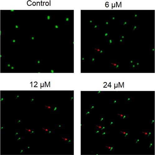 Figure 3. Heptazine induces DNA damage in SCC-15 cells. DNA damage analysis of the heptazoline-treated SCC-15 cells by Comet assay. Experiments were done in triplicate.