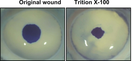 Figure 1 Representative images of corneas with original wound and those following treatment with Triton X-100 1%.