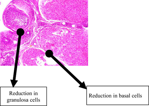 Figure 4 This figure shows the histological findings of the group that received tenofovir, which shows that there is a slight reduction in the granulosa and basal cells; follicles at various stages of maturation are distributed over the field.