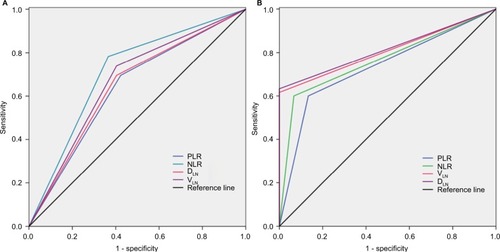 Figure 2 The ROC curves grouped by NLR, PLR, VLN, and DLN.Notes: (A) ROC curves based on therapeutic effect. NLR is represented by the green line with an AUC=0.709; PLR is represented by the blue line with an AUC=0.636; VLN is represented by the purple line with an AUC = 0.668; and DLN is represented by the red line with an AUC=0.616. (B) ROC curves for OS. NLR is represented by the green line with an AUC=0.767; PLR is represented by the blue line with an AUC=0.633; VLN is represented by the red line with an AUC=0.808; and DLN is represented by the purple line with an AUC=0.817. VLN, the GTV of metastatic lymph nodes; DLN, the maximum diameter of metastatic lymph nodes.Abbreviations: GTV, gross tumor volume; AUC, area under the curve; NLR, neutrophil-to-lymphocyte ratio; PLR, platelet-to-lymphocyte ratio; ROC: receiver operating characteristic.