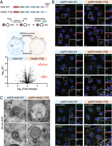 Figure 1. SQSTM1, NBR1 and LC3B are recruited to HGS-mutant endosomes. (a) Domain structure of APEX2-eGFP-HGS WT and APEX2-eGFP-HGS[Citation1-770], which is missing the C-terminal clathrin box. Cell lines stably expressing APEX2-eGFP-HGS WT or -HGS[Citation1-770] fusion proteins have been used for APEX2-proximity biotinylation of endosomally-recruited proteins. Volcano plot highlighting SQSTM1 and NBR1 enrichment in the APEX2-eGFP-HGS[Citation1-770] mass spectrometry sample; FDR p-value 0.05. (b) Immunofluorescence staining of HGS, SQSTM1 and NBR1 in cells stably expressing eGFP-HGS WT or eGFP-HGS[Citation1-770]. Cells are depleted for endogenous HGS or treated with control siRNA. The transgenic HGS WT and HGS[Citation1-770] are siRNA stable. Top panel: SQSTM1 and NBR1 are recruited to HGS[Citation1-770] endosomes (arrowheads indicating HGS, SQSTM1, NBR1 co-occurrence). Middle panel: LC3B is recruited with SQSTM1 and NBR1 to HGS[Citation1-770] endosomes, but not in eGFP-HGS WT expressing cells (arrowheads). Bottom panel: HGS[Citation1-770] endosomes display a strong ubiquitin (Ub) staining, which is not found in HGS WT or control cells. Scale bar: 10 µm; 5 µm for insets. (c) Representative electron micrographs of endosomes from HeLa cells stably expressing eGFP-HGS WT or HGS[Citation1-770], depleted for endogenous HGS. Cells are stimulated 60 min with EGF to induce EGFR internalization. The 10-nm gold particles mark EGFRs. In eGFP-HGS WT cells degraded EGFR clusters in lysosomes (arrow). In eGFP-HGS[Citation1-770] cells, EGFR is accumulating in a microdomain on the limiting membrane of endosomes (arrowheads). Bottom right panel shows an autophagosome containing a dysfunctional endosome. Scale bar: 250 nm.