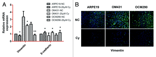 Figure 8. EMT was downregulated by cyclopamine in uveal melanoma cells. (A) Exposure to cyclopamine (20 μmol/L; 72 h) downregulated vimentin and upregulated E-cadherin mRNA, as determined by real-time RT-PCR. Gene expression was quantified using GAPDH as a normalization control. Data represent the mean ± SD of three determinations. (B) Vimentin protein expression was reduced following treatment with cyclopamine (20 μmol/L; 72 h), detected by immunocytochemistry.