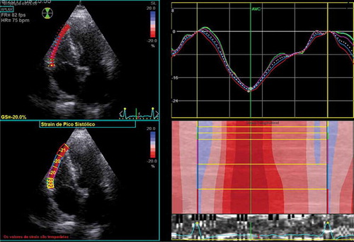 Figure 2. Patient selection flowchart. TTE, transthoracic echocardiography