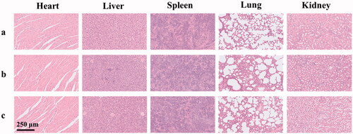 Figure 7. The histological characteristics of the main organs after treatment with glucose solution (a), SOF (b), and DOX@SOF (c) (×200).