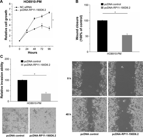 Figure 4 Cell proliferative, migratory, and invasive properties were repressed by pcDNA-RP11-190D6.2 in H08910-PM cells.