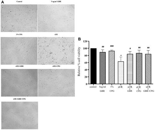 Figure 5 Effect of GBR cotreatment with cardioplegic solution in primary porcine cardiomyocytes subjected to sI/R injury. The cells were pretreated with GBR and cardioplegic solution for 24 hours. (A) The change of cell morphology was captured under microscopy (10X). (B) The percentage of cell viability was accessed by MTT assay (n=4). Each bar graph represents the mean±SD. One-way ANOVA analyzed data with Tukey’s Multiple Comparison Test, *p<0.0001 compared to control; #p<0.05, ##P<0.01, ###P<0.001 compared to sI/R.