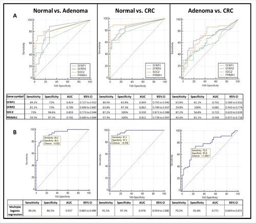 Figure 4. Receiver operating characteristic (ROC) curves for the 4 DNA methylation markers and the combined biomarker panel in plasma samples. ROC curves illustrate the sensitivity and specificity of SFRP1, SFRP2, SDC2, and PRIMA1 individually (A) and combined logistic regression analysis (B) in adenoma vs. normal, CRC vs. normal, and CRC vs. adenoma comparison in plasma samples. The calculated values for sensitivity, specificity, AUC, and the 95% confidence interval (CI) are tabulated in each panel. Using combined approach, the 4 markers together were able to distinguish CRC patients from normal individuals with 91.5% sensitivity and 97.3% specificity (AUC = 0.978, 95% CI: 0.954 to 1.000), and could differentiate adenoma samples from healthy controls with 89.2% sensitivity and 86.5% specificity (AUC = 0.937; 95% CI: 0.885 to 0.989). CRC: colorectal cancer; ROC: Receiver operating characteristic; AUC: Area under the curve; CI: Confidence interval.