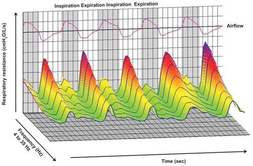 Figure 1 Representative sample of respiratory resistance in a three-dimensional graphic generated by MostGraph-01 (Chest MI, Inc, Tokyo, Japan). The X-axis shows the frequency from 4 Hz to 35 Hz, the Y-axis shows respiratory resistance, and the Z-axis shows the timecourse. The inspiratory and expiratory phases were based on the airflow of the subjects. The image was created based on the measured results for respiratory impedance.
