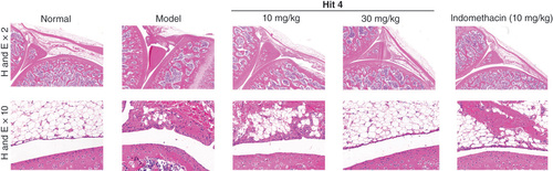 Figure 6. Histological changes of the ankle joints.Representative sections of ankle joints stained with hematoxylin and eosin. Cartilage damage, ×2, and synovial inflammation, ×200, were examined. In the Hit 4-treated samples, significant recovery of chondrocytes and cartilage was observed, indicating that Hit 4 promoted cartilage regeneration.