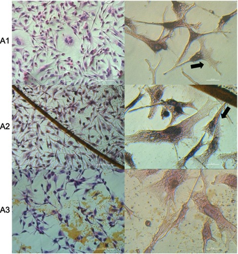 Figure 4 Morphology changes and affinity of HS-5 cells to the C60 nanofilms.Notes: Hematoxylin-eosin (H+E) staining of HS-5 cells on C60 nanofilms visualized using light optical microscopy. (A1) control group; (A2) C60-20%; and (A3): C60-100%. Black arrows indicate the direction of cell migration. Scale bars: left pictures 100 μm; right pictures 20 μm.Abbreviation: C60, fullerenes.