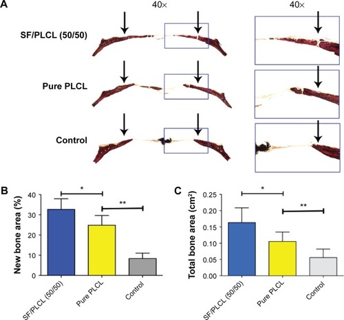 Figure 7 Histological evaluation of the newly formed bone.Notes: (A) The sliced specimens were stained with van Gieson’s picrofuchsin. Significant differences in reparative effects were observed among the SF/PLCL (50/50), pure PLCL, and control groups by analyzing (B) the newly formed bone area and (C) the percentage of newly formed bone with respect to total bone area. The arrows point out the fringe of the critical-sized calvarial bone defect. *P<0.05, **P<0.01.Abbreviations: PLCL, poly(lactide-co-ε-caprolactone); SF, silk fibroin.