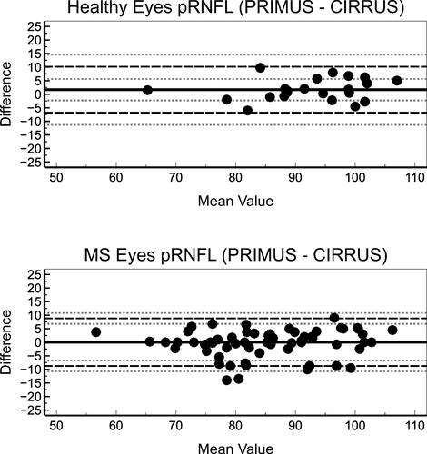 Figure 1 Bland-Altman plots depict the agreement between PRIMUS and CIRRUS for RFNL measurement in healthy (top) and MS patients’ eyes (bottom).