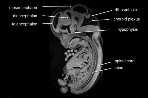 Figure 12.  Embryo structures visualized by MR image (Carnegie stage 23).
