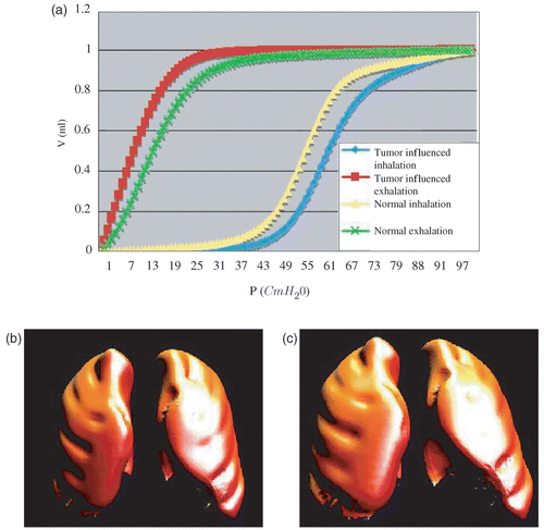 Figure 6. The physics-based breathing model. (a) depicts the pressure-volume relation, and (b) and (c) are two meshes of the breathing model obtained with the reference 4D CTs. (b) is the end-expiration mesh, and (c) is the end-inspiration mesh. This is the initial breathing model (based on a reference image) before any adaptation to a specific patient. [Color version available online.]