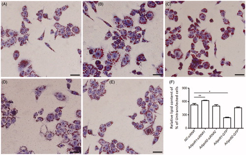 Figure 3. Intracellular lipid accumulation in AdipoR1 and AdipoR2 silencing and overexpressing preadipocyte. (A) NC-siRNA preadipocytes; (B) AdipoR1- siRNA1 preadipocytes; (C) AdipoR2- siRNA2 preadipocytes; (D) AdipoR1-GFP overexpressed preadipocytes; (E) AdipoR2-GFP overexpressed preadipocytes; Bars = 25 μm. (F) Quantitative analysis of Oil Red O stained cells in preadipocytes during differentiation 7 days. Values are means ± SEM of duplicate independent analyses. *p < .05; **p < .01.
