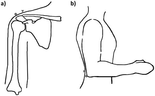 Figure 2. Visualisation (not true to scale) of different landmarking methodologies in ISO 7250-1 (dots) and the SHIP reading procedure (triangles) for the (a) acromion and (b) olecranon (own drawing).