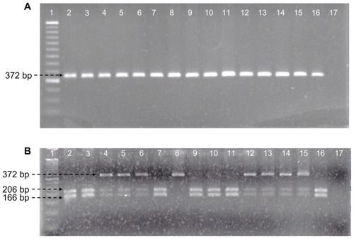 Figure 1 Identification of ADIPOQ +45T>G polymorphism. (A) PCR amplification fragments. Line 1, molecular weight marker of 50 bp; lines 2–16, samples; line 17, negative control. (B) Bsp HI restriction fragments. Line 1, molecular weight marker of 50 bp; lines 2, 3, 7, 9–11, and 16, TT genotype; lines 4–6 and 12–15, TG genotype; line 8, GG genotype; line 17, negative control.