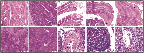 Figure 2. Representative micrographs for duodenum (A–E) and spleen (F-G) of broiler chickens treated with different levels AgNPs for 42 days, H&E stain. A) Duodenum from control group showing normal epithelium with no lesions. (B) Duodenum from 2.5 mg supplemented group showing normal structure of intestinal villi. (C) Duodenum from 5 mg group showing necrosis and sloughing of epithelium (arrow). (D) Duodenum from 10 mg showing epithelial metaplasia (arrow). (E) Duodenum from 20 mg group showing epithelial metaplasia (arrow). F) Spleen from control group showing normal red and white pulp with normal lymphoid follicle. (G) Spleen from 2.5 mg group showing normal red and white pulp with normal lymphoid follicle. (H) Spleen from 5 mg group showing congestion of the blood vessels, desquamation of endothelium (arrow) and perivascular infiltration. (I) Spleen from 10 mg group showing necrosis of the lymphoid follicle (arrow). (G) Spleen from 20 mg group showing necrosis of the lymphoid follicle (arrow).