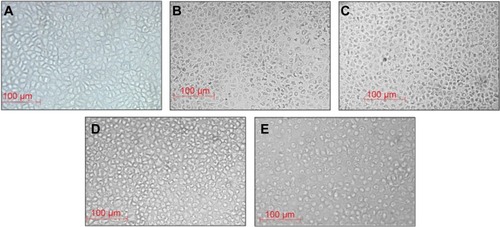 Figure 6 Cytotoxic activity of AgNPs.Notes: Effect of AgNPs on human breast cancer cell line (MCF-7) at different concentrations: (A) control, (B) 1.65 μg/mL, (C) 3.75 μg/mL, (D) 7.5 μg/mL, and (E) 15 μg/mL.Abbreviation: AgNPs, silver nanoparticles.