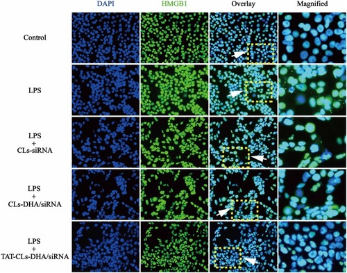 Figure 7 Different formulations, including CLs-siRNA, CLs-DHA/siRNA and TAT-CLs-DHA/siRNA liposomes inhibits LPS-induced HMGB1 translocation from nucleus to cytoplasm in MMC cells. Intracellular HMGB1 was visualized with green immunofluorescent FITC-staining.