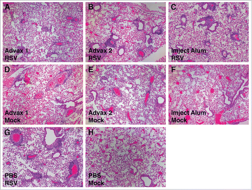 Figure 5. Histopathology images of lungs after RSV challenge. BALB/c mice were vaccinated with RSV vaccine with various adjuvants and infected with the RSV line 19 at 4 weeks after the final vaccination. Lungs were collected 4 d post-infection, formalin fixed, and paraffin embedded. Representative images from hematoxylin-and-eosin-stained sections: RSV vaccine plus Advax-1 (A), RSV vaccine plus Advax-2 (B), RSV vaccine plus Imject Alum (C), Mock vaccine plus Advax-1 (D), Mock vaccine plus Advax-2 (E), Mock vaccine plus Imject Alum (F), RSV vaccine only (G), and Mock vaccinated with mock adjuvant (H).