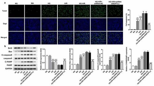 Figure 3. Silencing of ANGPTL2 suppresses the apoptosis of HG-H/R induced H9c2 cells. (a) The apoptosis of H/R-H9c2 or HG-H/R-H9c2 cells transfected with shRNA-ANGPTL2 was detected using TUNEL assay. (b) The protein levels of apoptosis-related factors in H/R-H9c2 cells or HG-H/R-H9c2 transfected with shRNA-ANGPTL2 was analyzed by Western blot. ***P < 0.001 vs. NG group. ###P < 0.001 vs. MA group. @@P < 0.01 and @@@P < 0.001 vs. HG-H/R group. &&&P < 0.001 vs. HG-H/R+ shRNA-NC group.