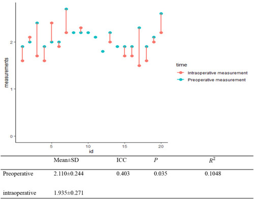 Figure 3 Comparison of pre- and intra-operative ultrasound measurement of recurrent laryngeal nerve (RLN).