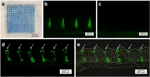 Figure 6. Fluorescence micrographs of HA MNP loaded with carboxyfluorescein-labeled EXT after skin insertion. (a) Bright-field micrographs of neonatal pig skin after in vitro insertion of methylene blue-loaded MNP. (b) Skin before and (c) after 2 min of insertion. (d) Fluorescence of histological sections of pig skin puncture sites (white arrows) and (e) combined bright-field and fluorescence images. Copyright 2014, Springer.