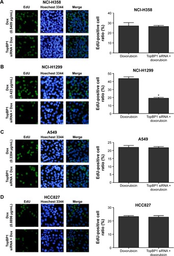 Figure 4 Measurement of cell proliferation in TopBP1 siRNA-transfected lung cancer cells.