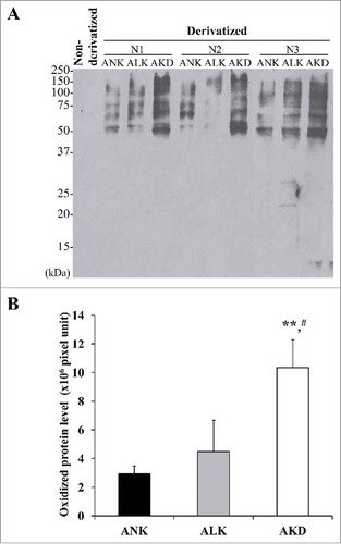 Figure 3. Levels. of oxidatively modified proteins. (A): After MDCK cells were maintained in ANK, ALK or AKD medium for 24 h, OxyBlot assay was used to quantify DNP-derivatized or carbonylated proteins (non-derivatized sample served as a negative control). (B): Band intensity was measured. Each bar represents mean ± SD of 3 independent experiments. ** = p < 0.01 vs. ANK; # = p < 0.01 vs. ALK.
