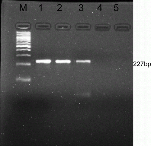 Figure 2.  PCR amplified product 227 bp specific to T. evansi.M, Marker ladder of 100 bp; Lane 1, 2 and 3, Positive sample; Lane 4, Negative sample; Lane 5, Negative control.