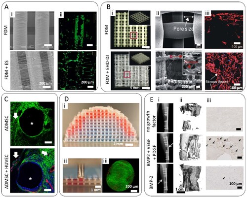 Figure 5. Combination of ME-AM scaffolds with fibrous and hydrogel networks. (A) (i) SEM images of bare PCL scaffolds, and scaffolds fabricated combining ME-AM of PCL and ES of PLGA nanofibres. (ii) Fluorescent microscopy images of MC3T3 (F-actin, green) cultured for 7 days on the aforementioned scaffolds. Adapted with permission from Ref. [Citation162]. (B) (i) Optical and (ii) SEM images of bare PCL scaffolds, and hybrid scaffolds fabricated combining ME-AM of PCL and EHD-DJ of collagen struts. (iii) Confocal fluorescent microscopy images of MG63 (F-actin, red; nuclei, blue) cultured for 7 days on the aforementioned scaffolds. Adapted with permission from Ref. [Citation166]. (C) Immunohistochemistry fluorescent images of in vivo vascularization within PCL/HA scaffolds seeded with cell-laden GelMA hydrogels containing either ADMSC, or ADMSC combined with HUVEC (CD31, red; a-smooth muscle actin, green; nuclei, blue; aSMA). Scaffolds were implanted for 4 weeks subcutaneously. Asterisks indicate the PCL/HA scaffold filaments. Arrows indicate the stained cells/microvessels positive for human CD31. Adapted with permission from Ref. [Citation167]. (D) (i) Biphasic hemispherical construct with stained GelMA hydrogel micro-spheres representing the chondrogenic (red) and osteogenic (blue) phase of an osteochondral construct. (ii) This construct was fabricated by applying a bottom-up automated tissue bioassembly strategy, consisting of the automated insertion of microtissues within the ME-AM scaffold pores. (iii) Fluorescence microscopy images of injected human articular cartilage microtissues stained with Calcein (live cells, green) and Propidium Iodide (dead cells, red). Adapted with permission from Ref. [Citation168]. (E) (i) Representative X-rays and (ii) µCT reconstructions of bone formation after hybrid scaffold implantation on ovine tibial defects. Scaffolds consisted of a PCL ME-AM structure, loaded with a platelet-rich plasma hydrogel containing microparticles for the delivery of BMP-2 or a combination of BMP-2, VEGF and PDGF. (iii) Representative images from defect mid-sections showing immunohistochemical staining for the endothelial marker Von Willebrand Factor. Adapted with permission from Ref. [Citation169].