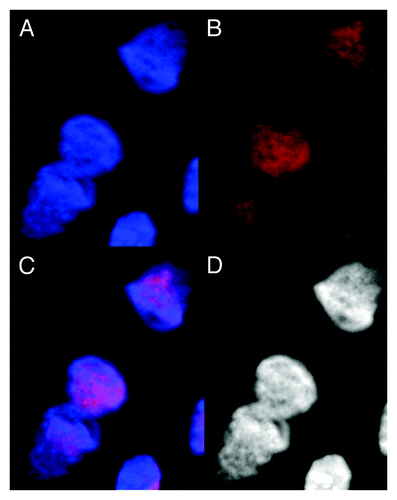 Figure 3. Images of dsDNA (DAPI, blue) and dsRNA/DNA (TRITC-Ab, red) stain in metakaryotic syncytial nuclei undergoing symmetric amitoses in fetal spinal cord, 10 wks. (A) DAPI fluorescence (blue). (B) TRITC-Ab fluorescence (red). (C) Merged images of (A) and (B) showing nuclei labeled simultaneously with DAPI and TRITC-Ab-n3. (D) Achromatic image of (A). Scale bar, 5 µm. Image by Koledova VV.
