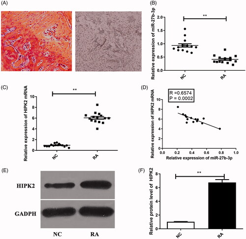 Figure 1. Expression levels of miR-27b-3p and HIPK2 in cartilage tissues from RA and NC patients. (A) The H&E staining demonstrated the pathological features of RA.The expression of (B) miR-27b-3p and (C) HIPK2 mRNA in cartilage tissues. (D) The correlation between miR-27b-3p and HIPK2 mRNA expression in RA cartilage tissues. (E,F) The expression of HIPK2 protein in RA cartilage tissues. The normal articular cartilage tissues were served as control. **p < .01.