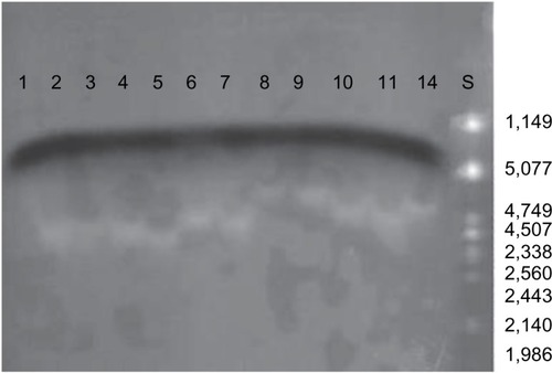 Figure 5 Agarose gel electrophoresis of plasmids extracted from various E. coli isolates.Notes: Numbers 1–11 water isolates, 14 clinical isolates. S-ladder λ DNA (Pst1) Kb; (1% agarose, 50 vol, 1.5 hours).
