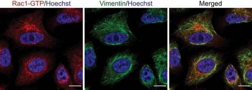Figure 1. Staining from the anti-Rac1-GTP antibody colocalizes with vimentin. Representative image of PC3 cells that have been fixed and stained for vimentin (green), DNA (blue), and with the anti-Rac1-GTP antibody (red). Scale bar, 10 μm.