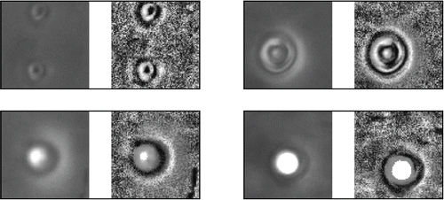 Figure 5. Enhancement of bubble contrast during ACC application; particle image size is 32 × 32 μm.