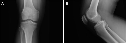 Figure 1 X-ray films for Case 1.