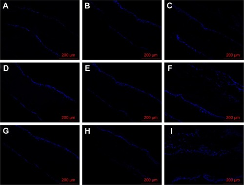 Figure 8 Infiltration of BMSCs into different scaffolds by DAPI.Notes: BMSCs were seeded on different scaffolds up to 14 days, and cell nuclei were stained with DAPI. AFS (A, D, and G), AYS (B, E, and H), and HS (C, F, and I) at days 3 (A–C), 7 (D–F), and 14 (G–I). Scale bars: 200 μm for all images.Abbreviations: AFS, aligned nanofiber scaffolds; AYS, aligned nanoyarn scaffolds; BMSCs, bone marrow-derived mesenchymal stem cells; DAPI, 4′,6-diamidino-2-phenylindole; HE, hematoxylin and eosin; HS, hybrid scaffold.