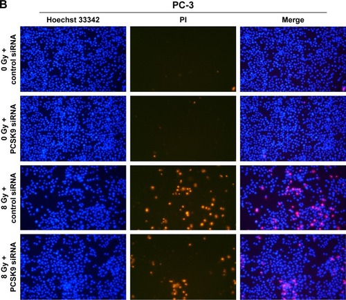 Figure 2 Inhibition of PCSK9 increases radioresistance in PCa cells exposed to IR.