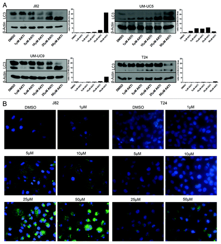 Figure 8. Concentration-dependent effects of AZ7328 on autophagy. (A) Immunoblot displaying LC3-I and LC3-II expression in four representative cell lines (J82, UM-UC-5, UM-UC-9 and T24). The LC3 bands were quantified using Image J software and the bar graphs show the ratio of LC3-II to LC3-I as a function of autophagy. (B) Immunofluorescence analysis of LC-3 localization in J82 and T24 cells. Note that punctate LC-3 staining (green) is characteristic of autophagy.