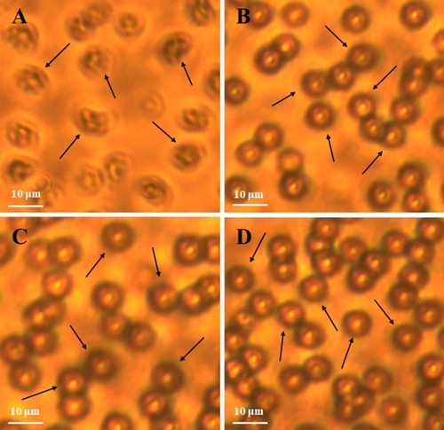 Figure 13 Morphology of rRBC after treatment with 1% triton (A), normal blank liposomes (B), blank cationic liposomes (C) and PCC liposomes (D) observed by inverted fluorescence microscope.Abbreviations: PCC, photo-responsive Camellia sapogenin derivative cationic; rRBC, rabbit red blood cells.
