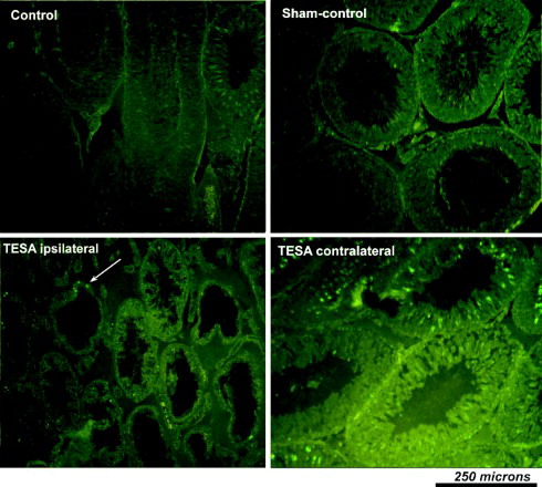 Figure 5.  Photomicrograph of testis taken from various experimental groups after staining with TUNEL technique to demonstrate apoptotic positive cells. No obvious apoptotic cells seen in control and sham-control. However, increased apoptosis of germ cells was seen in TESA testis (predominantly in the regions of germ/sperm cells). Though it appears that the number of apoptotic positive cells were relatively reduced in TESA ipsilateral testis when compared to other groups and contralateral side, actually it was because of the loss of seminiferous epithelia and sperm cells in majority of the tubules after TESA. TESA: testicular sperm aspiration; MESA: microsurgical epididymal sperm aspiration