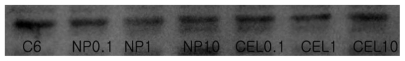 Figure 9 Western blot analysis for COX-2 protein in C6 rat glioma cells. Each lane is as follows: C6 cells treated with celecoxib or PLGA nanoparticles incorporating celecoxib.