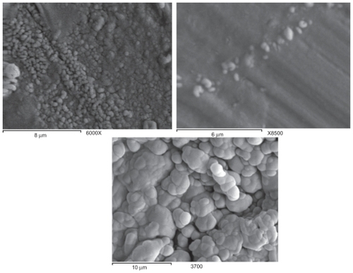 Figure 1 SEM images for a) the progesterone nanosuspension after lyophilization; b) the progesterone nanosuspension sample before lyophilization; c) the progesterone powder as received.