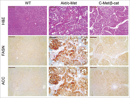 Figure 4. Expression of FASN and ACC is not elevated in c-Met/β-catenin mouse tumor tissues (right panel), when compared with HCCs induced by AKT/c-Met overexpression (middle panel). Scale bar: 200µm. Abbreviations: WT, wild-type; FASN, fatty acid synthase; ACC, acetyl-CoA carboxylase; HE, hematoxylin and eosin staining.
