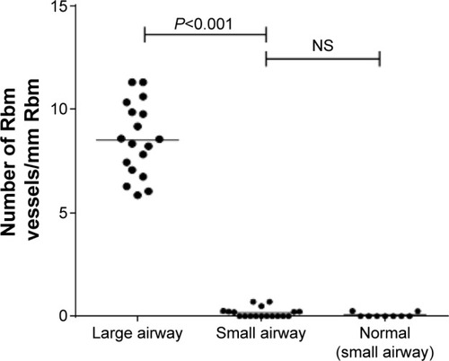 Figure 8 Number of vessels in Rbm in large airway of CAL compared with CAL small airway and normal control small airway.