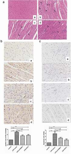 Figure 5. TRIM31 deletion suppressed apoptosis in mice model of sepsis induced by LPS. (a) H&E staining was performed on heart tissue samples of animal models. (b) IHC was used to detect the protein level of NF-κB (c) TUNEL assay was performed to measure apoptosis in heart tissue samples of animal models. a, control; b, LPS + vector; c, LPS + shTRIM31; d, LPS + PDTC